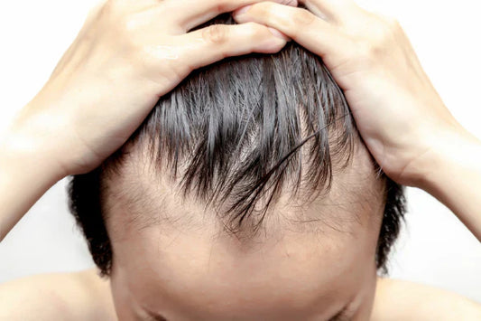 How to get rid of a dry scalp